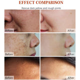 Load image into Gallery viewer, Korean Natural Vegan Neck Facial Vitamin C Acne Pimples Dark Spot Remover