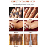 Load image into Gallery viewer, Korean Natural Vegan Neck Facial Vitamin C Acne Pimples Dark Spot Remover